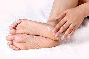 tratamento de creme para fungos na pele dos pés